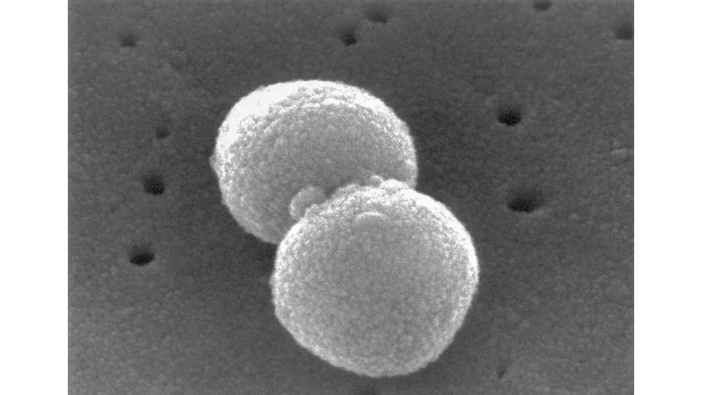 Scanning electron micrograph of Streptococcus pneumoniae.