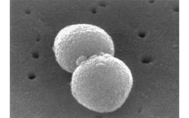 Scanning electron micrograph of Streptococcus pneumoniae.