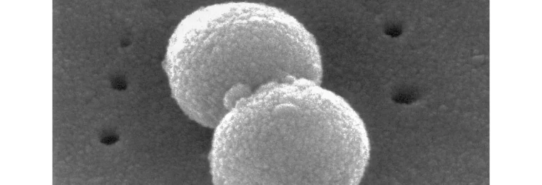 Scanning electron micrograph of Streptococcus pneumoniae.